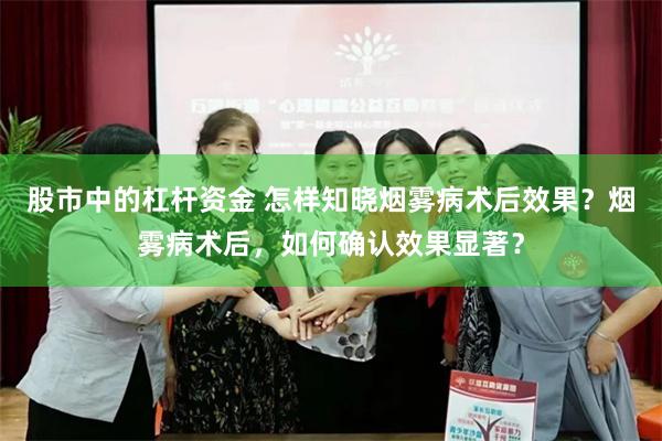 股市中的杠杆资金 怎样知晓烟雾病术后效果？烟雾病术后，如何确认效果显著？